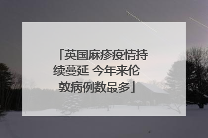 英国麻疹疫情持续蔓延 今年来伦敦病例数最多